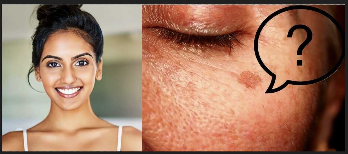 How to Treat Pigmentation Safely Without Damaging Skin